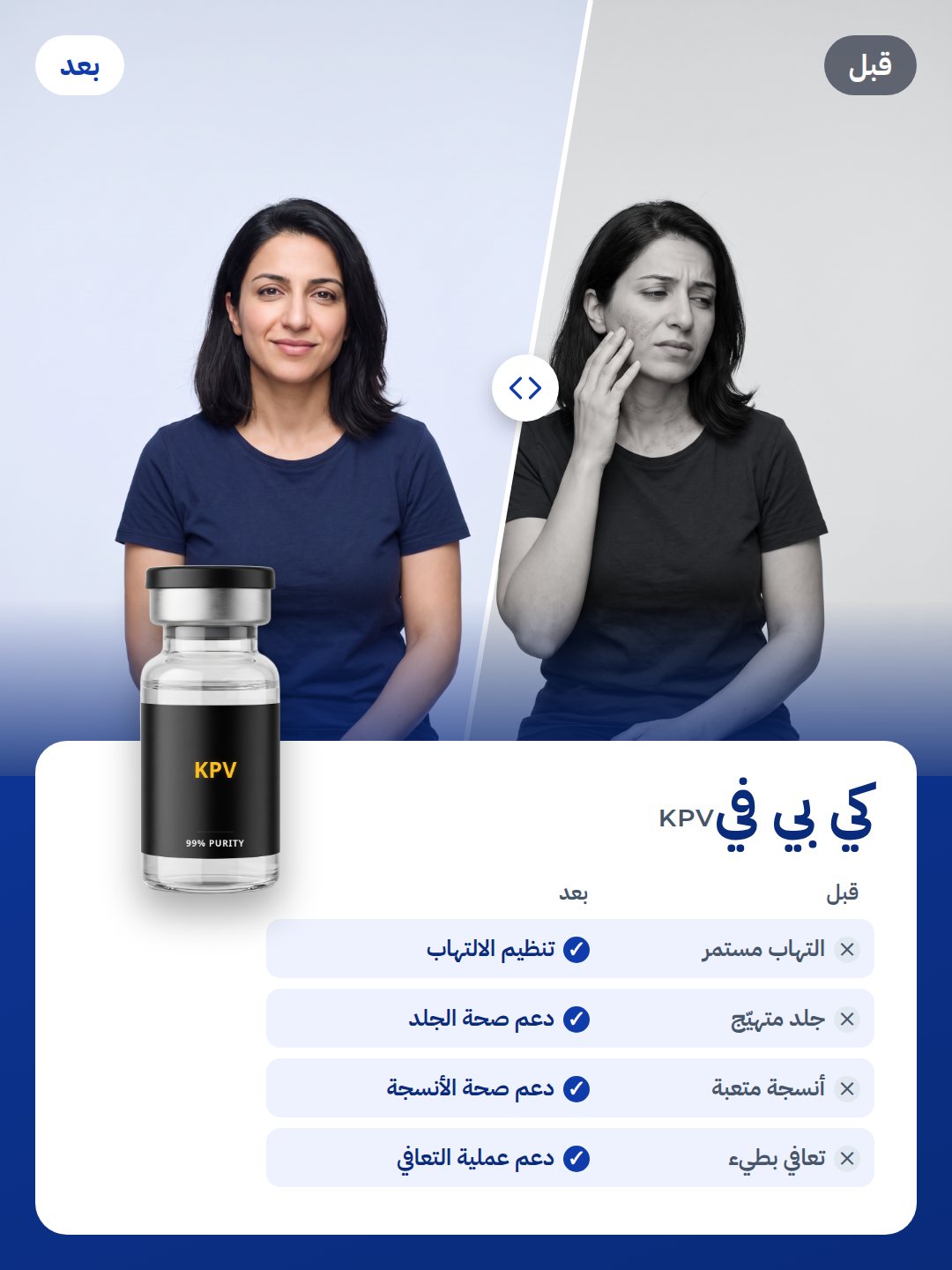 KPV: قبل وبعد